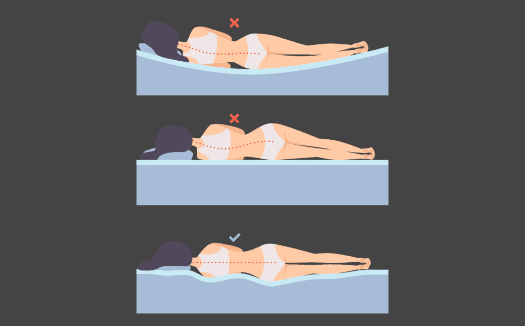 BICO Eine optimale Matratze lässt die Wirbelsäule gerade ruhen